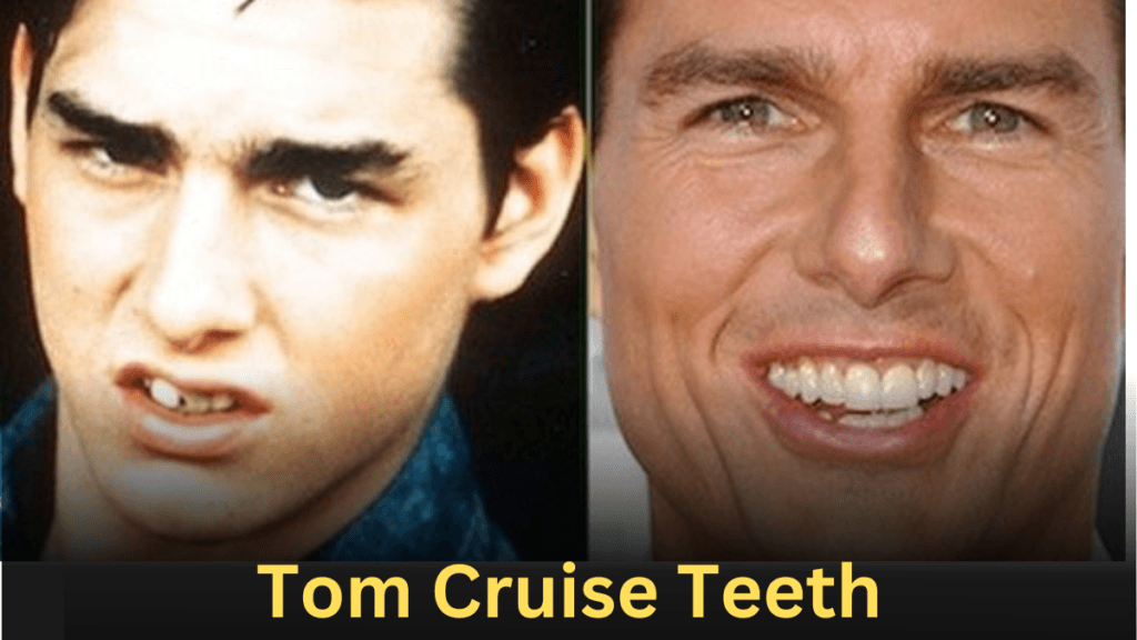 tom cruise teeth